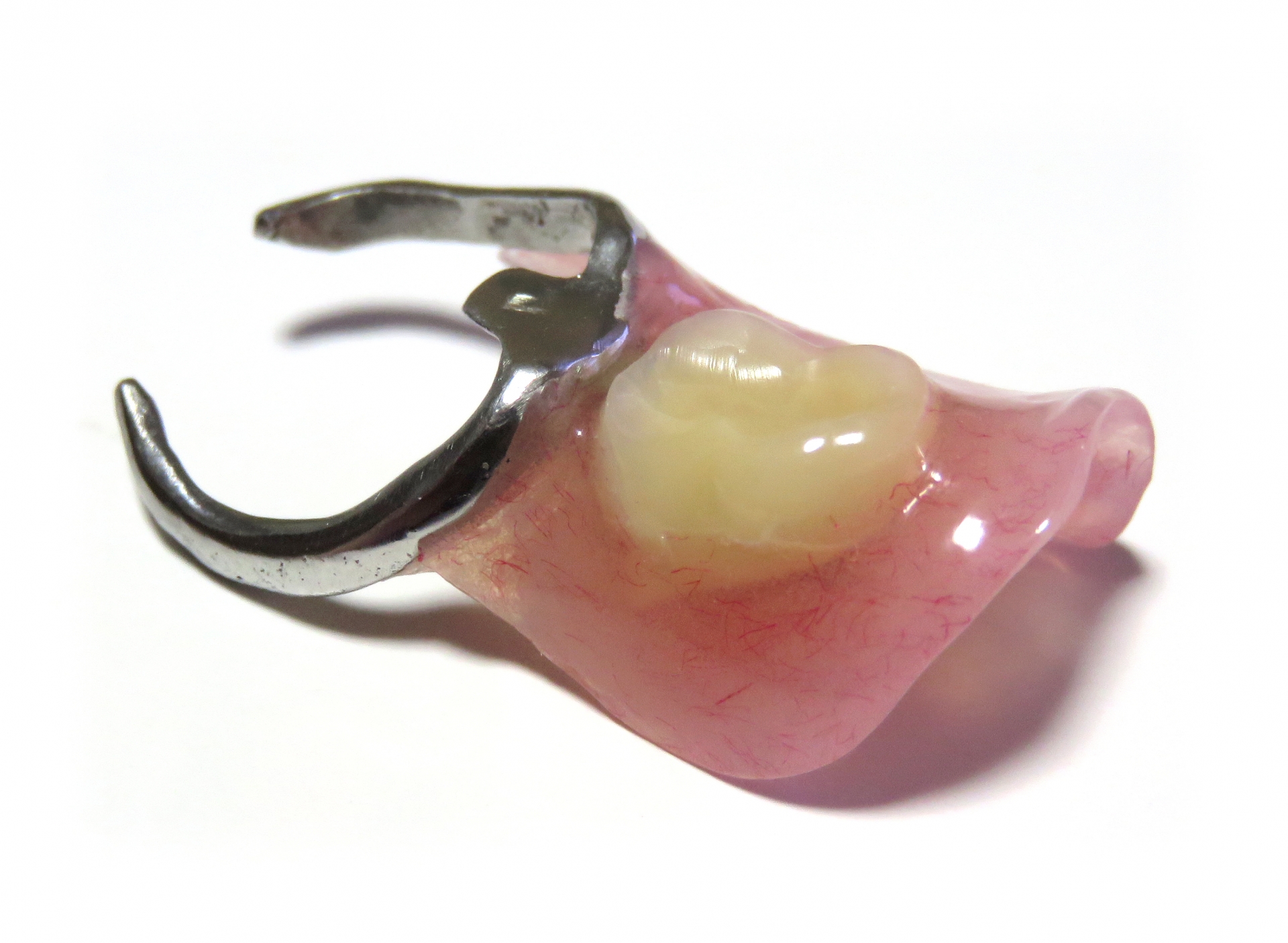 部分入れ歯は他の歯にバネをかけて支えます