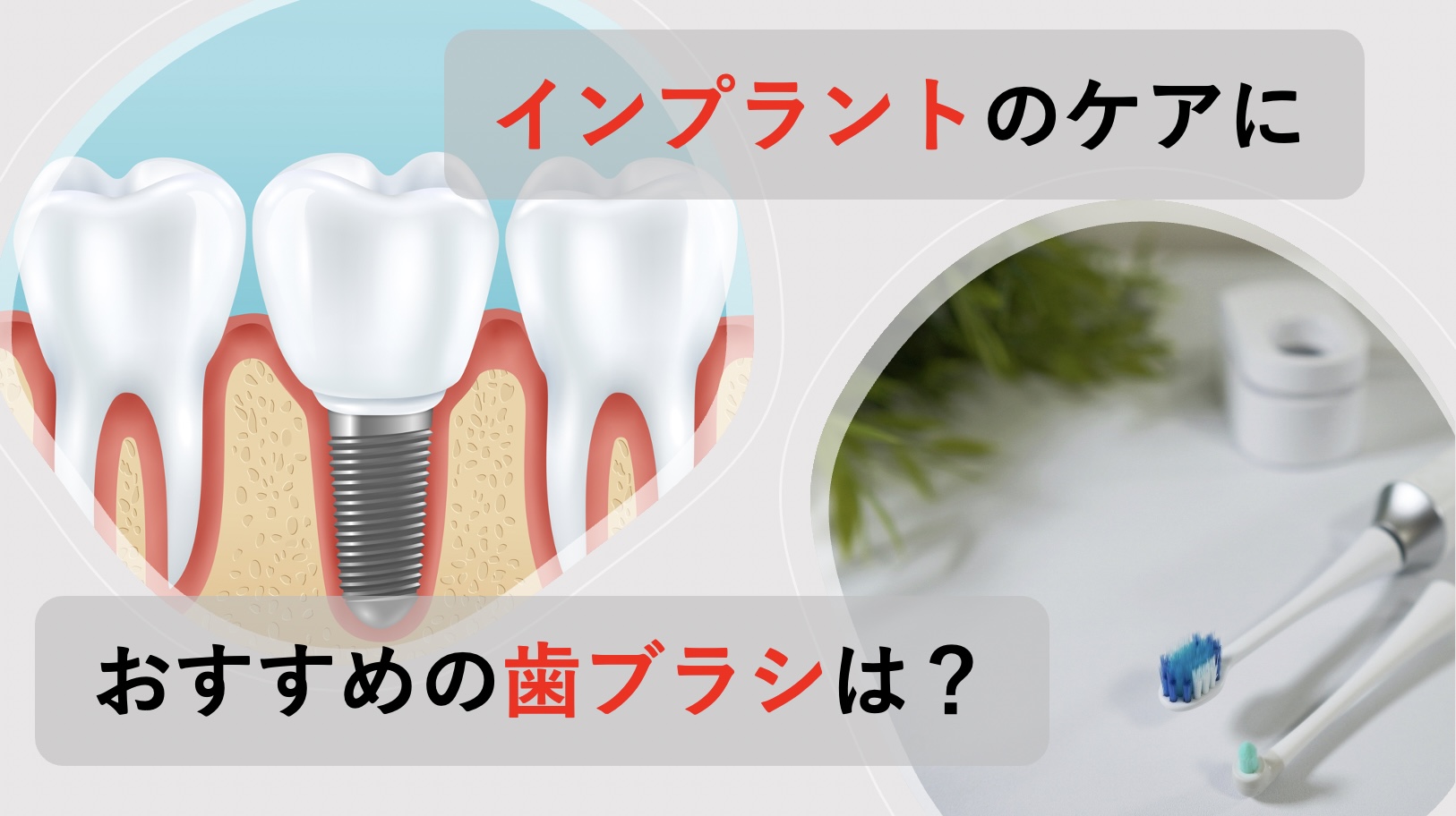 インプラントのケアにおすすめの歯ブラシは？